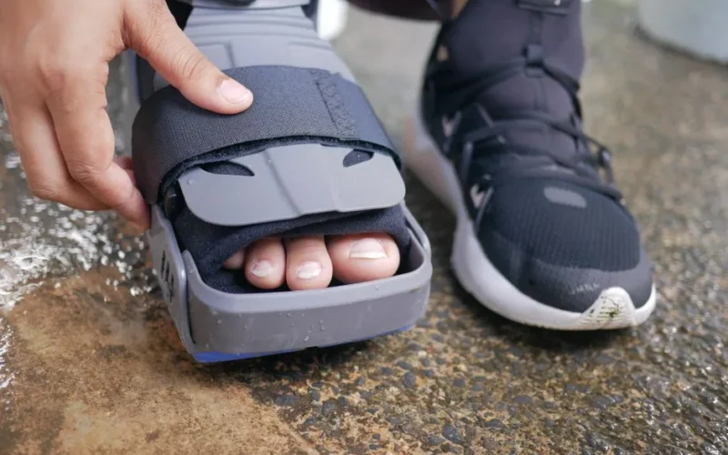 Detailed close-up of a foot in an orthopedic brace, highlighting post-injury recovery.