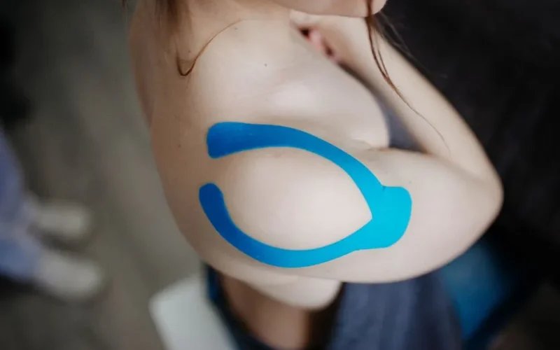 Close-up of a shoulder with kinesiology tape applied for muscle support during sports activities.