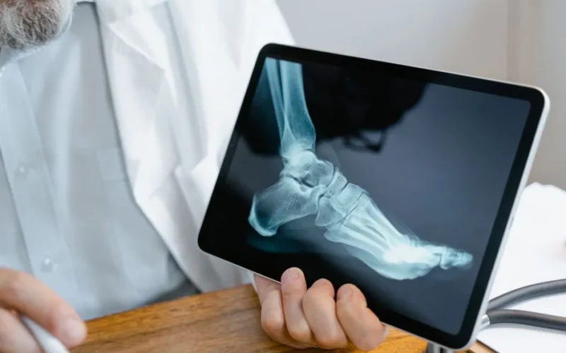 A doctor examines an x-ray image of a foot displayed on a tablet.